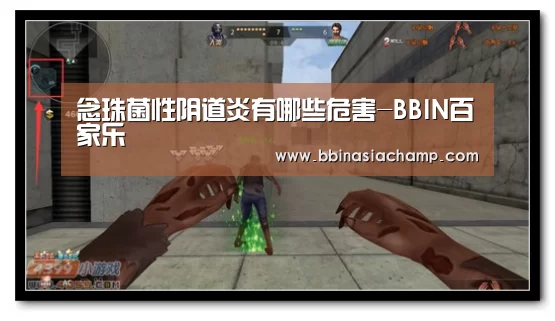 BBIN捕鱼