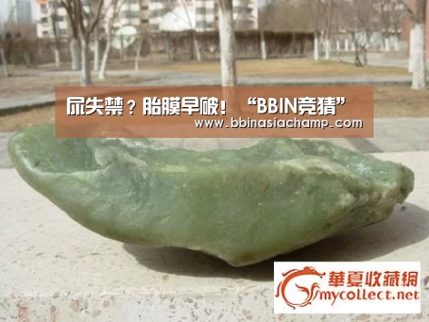 尿失禁?胎膜早破!“BBIN竞猜”(图2) BBIN百家乐